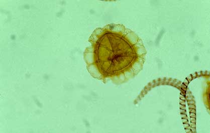 APII jpeg image of Asterella drummondii  © contact APII