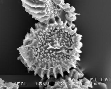 APII jpeg image of Fossombronia maritima  © contact APII