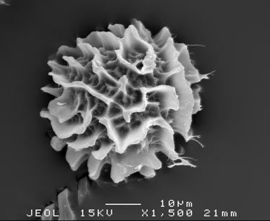 APII jpeg image of Fossombronia altilamellosa  © contact APII