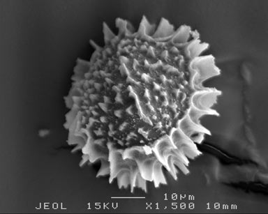 APII jpeg image of Fossombronia pusilla  © contact APII